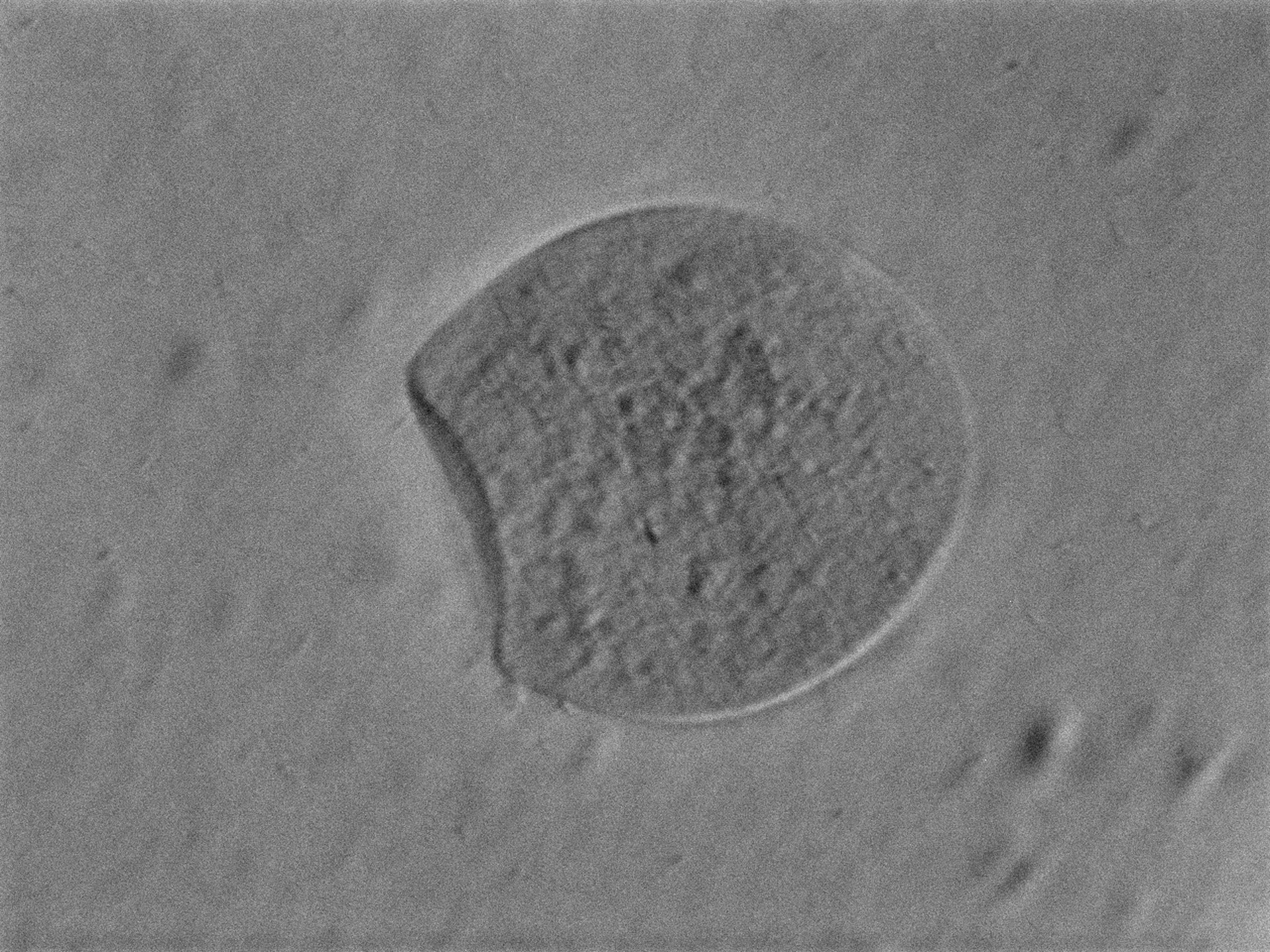 Phase-contrast micrograph of a single alginate particle being degraded by Vibrio cyclitrophicus ZF270 at 40× magnification.